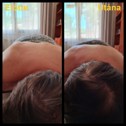 Third image
